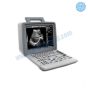 سونار اوميجا Ultrasound Omega - XF300 - Black&White